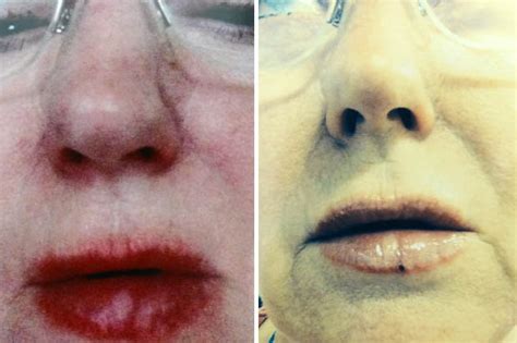 dior lip oil allergic reaction